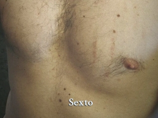 Sexto